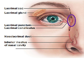 Diseases of the lacrimal sac